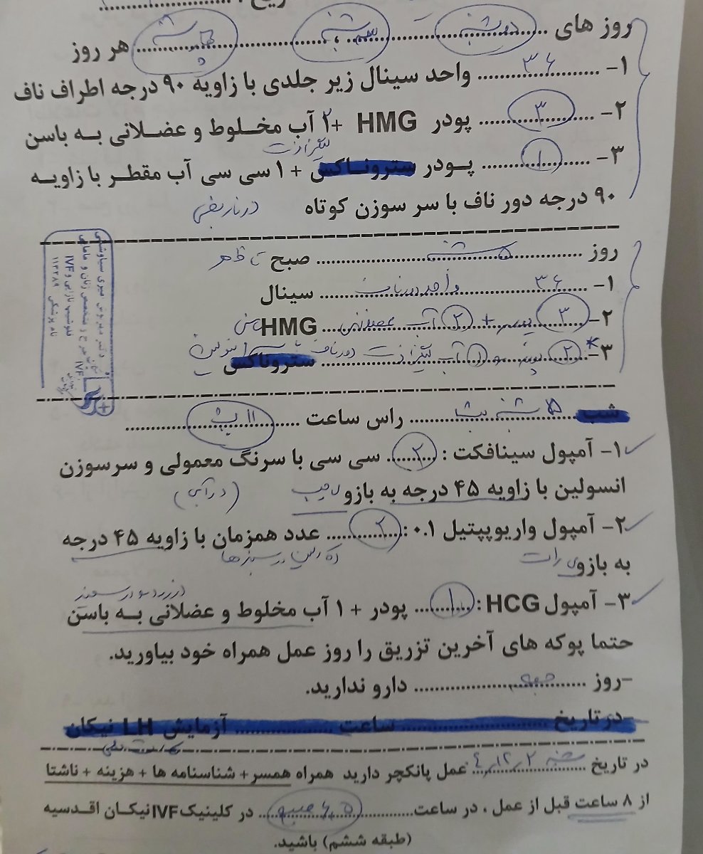 اقدام برای ای وی اف