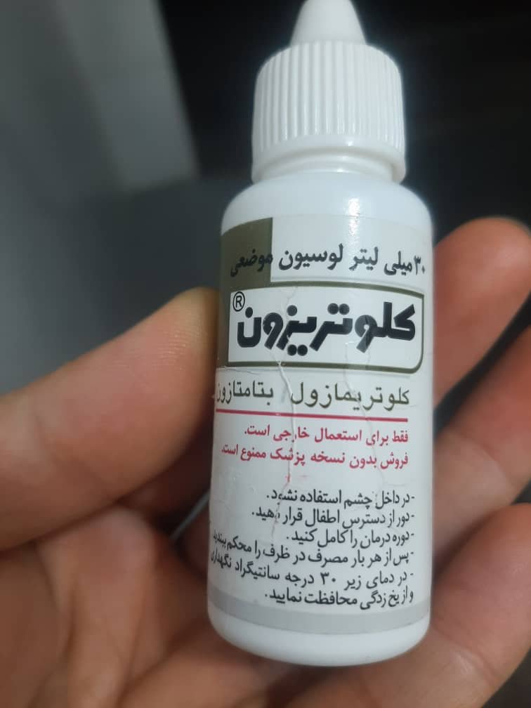 اینه 