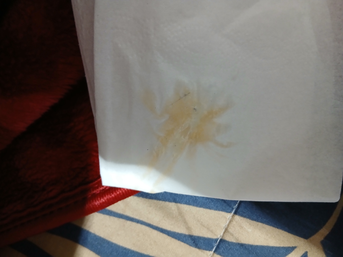 اورژانسی!!!دکتر جان ترشحات نارنجی رنگ واژن توی بارداری نشونه چیه؟؟؟