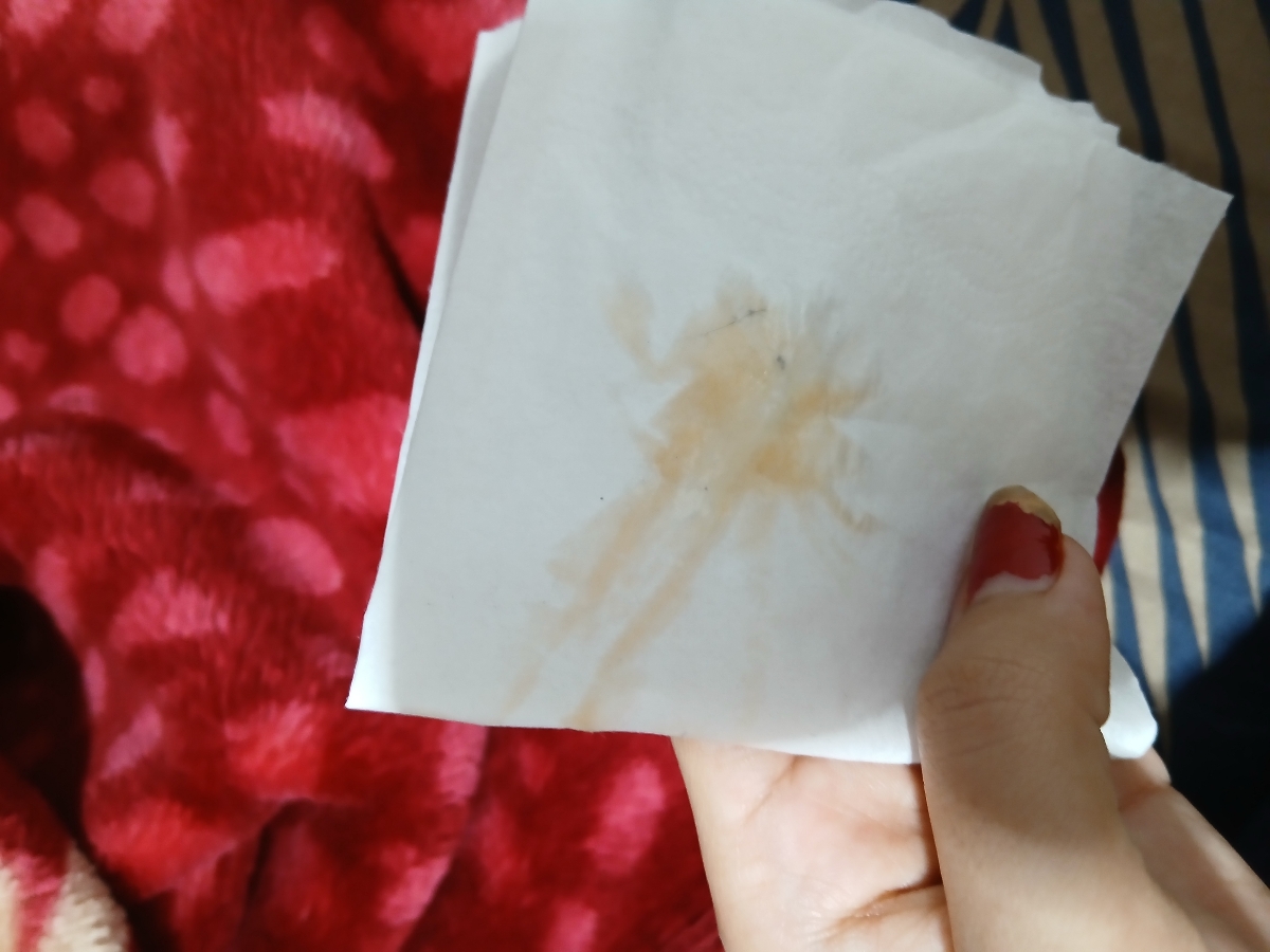 اورژانسی!!!دکتر جان ترشحات نارنجی رنگ واژن توی بارداری نشونه چیه؟؟؟