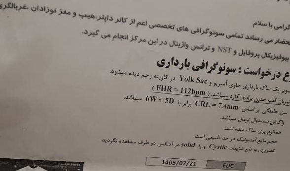 برادی کارد ضربان جنین