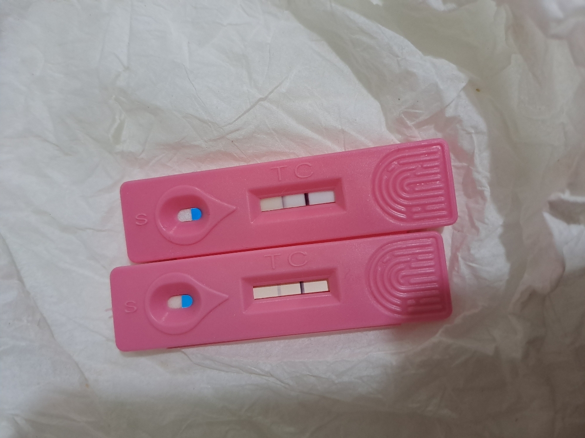 با وجود کیست میشه باردار شد