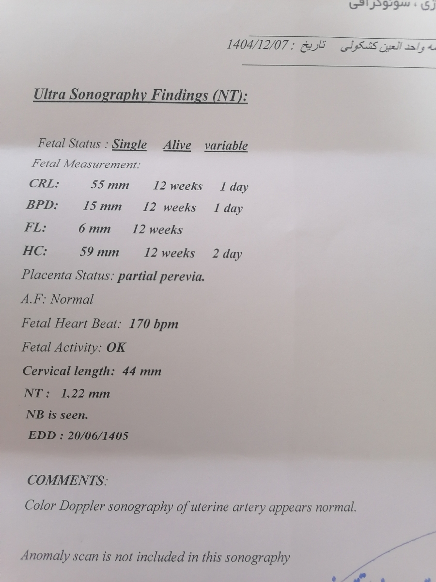 تفسیر سونو ان تی