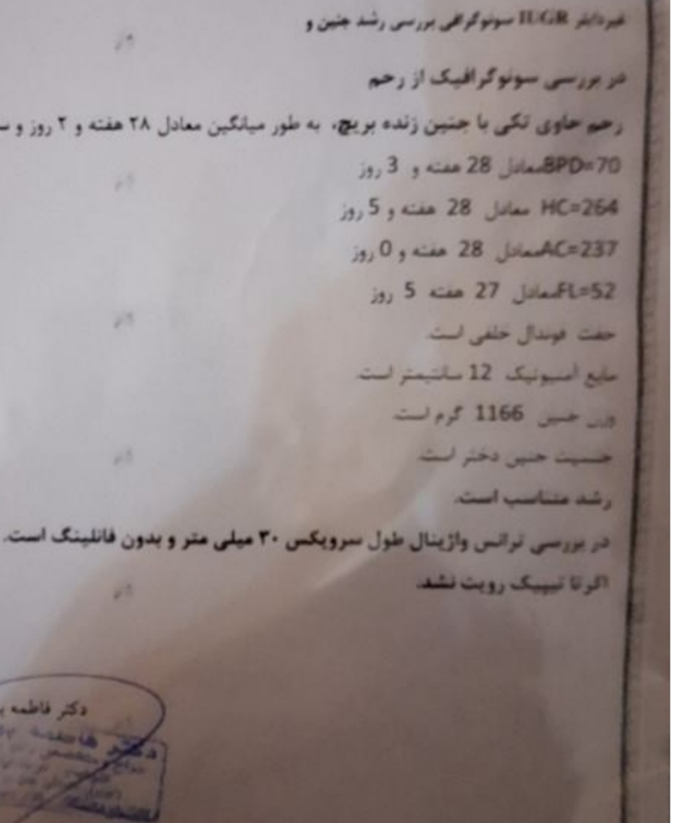 سونو در هفته ی ۳۲