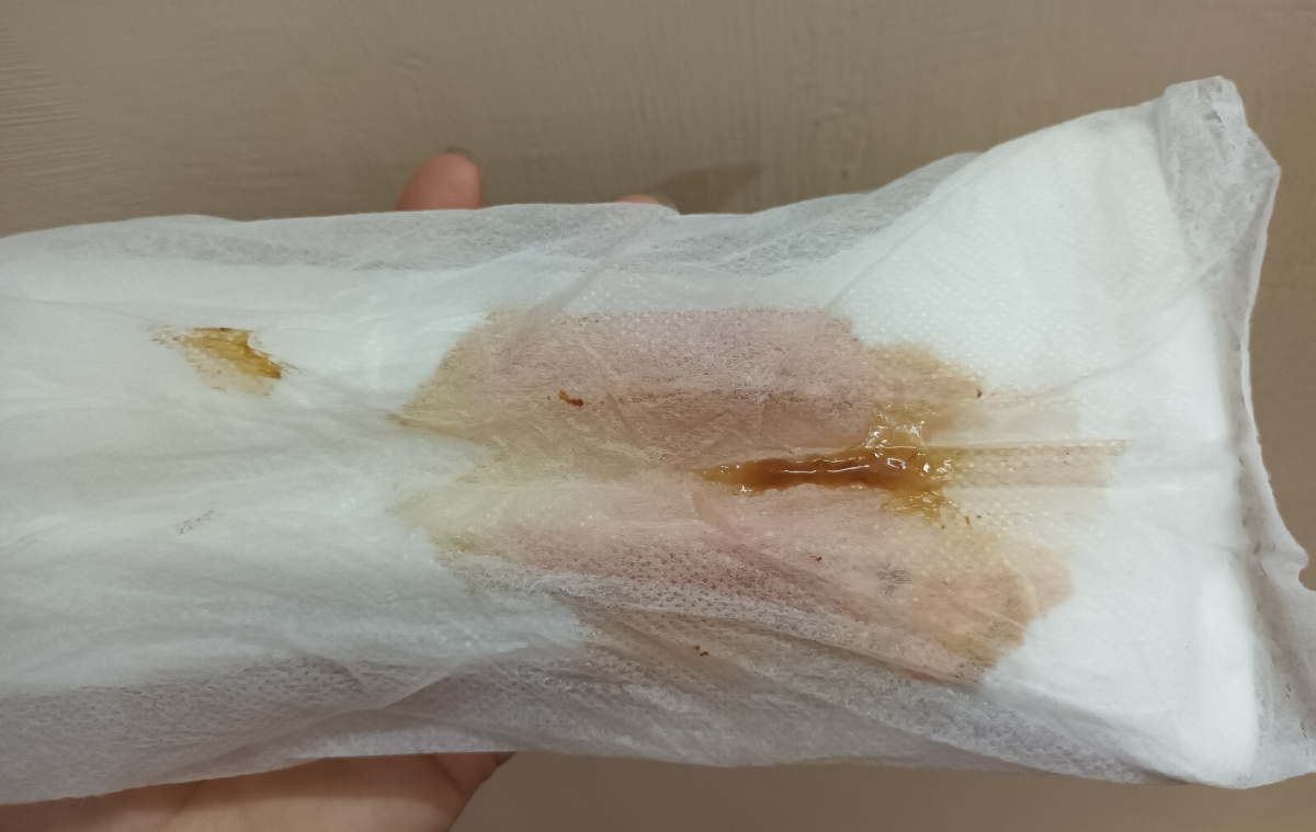 این ترشحات برای چند ساعته این ترشحات برای چند ساعته