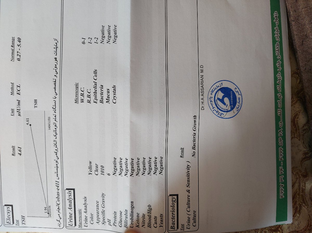 تفسیر سونو وآزمایش