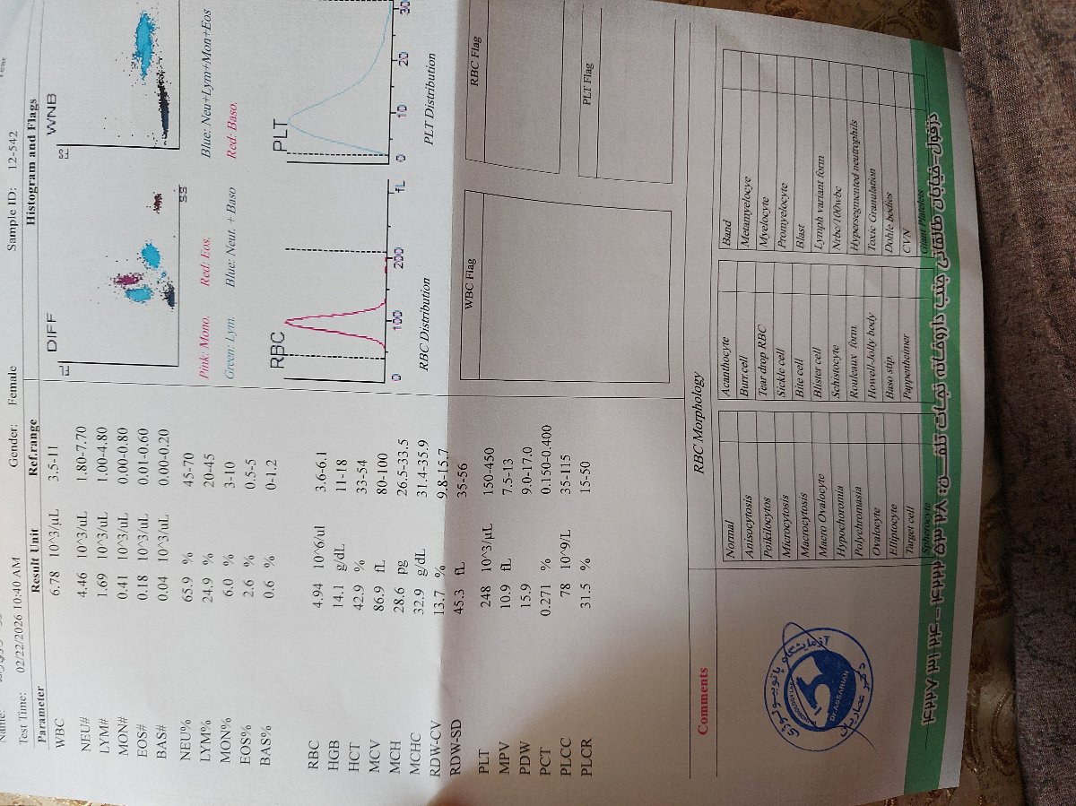تفسیر سونو وآزمایش