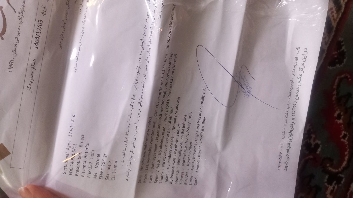 تفسیر سونو انومالی هفده هفته