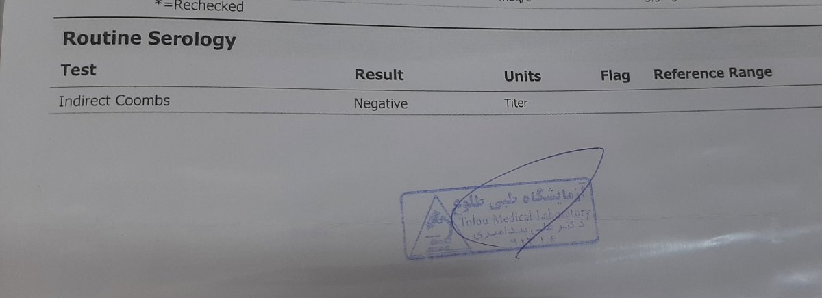 تزریق امپول روگام و ازمایش تزریق امپول روگام و ازمایش