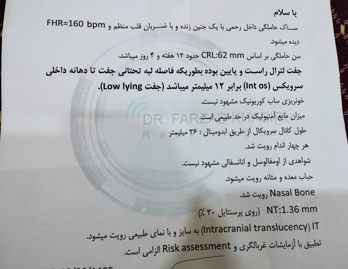 تفسیر سونو ان تی تفسیر سونو ان تی