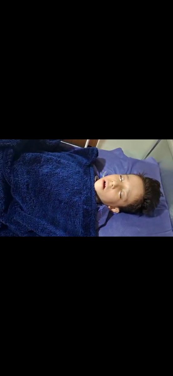 عمل لوزه و مراقبت های قبل و بعد عمل لوزه و مراقبت های قبل و بعد