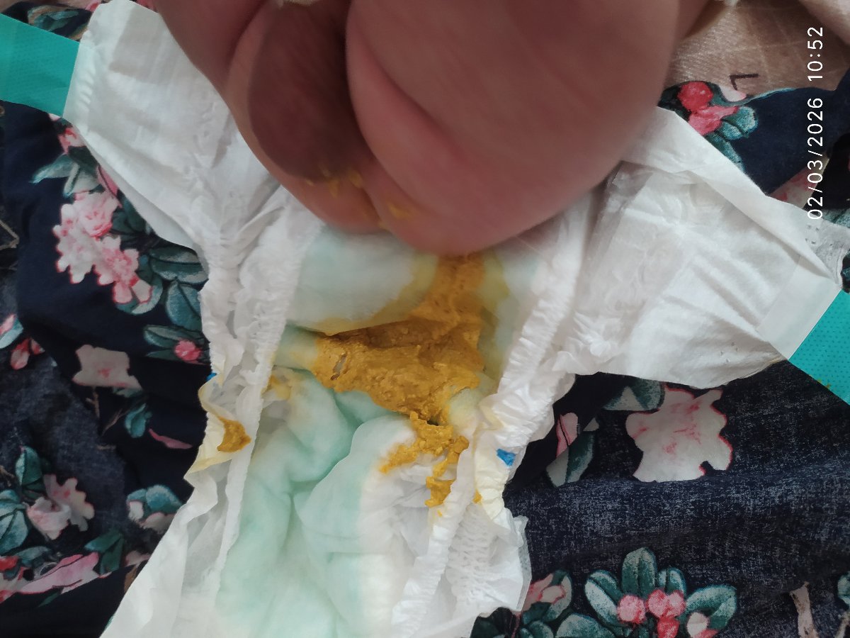 این مدفوعیه ک شیر خشک بیومیل پلاس رو میخوره 🤦🏿♀️
حالا نمیدونم اینطوری باید باشه یا ن
ولی نان رو میخوره روون تره این مدلی نیست
ببخشید توروخدا بابت عکس این مدفوعیه ک شیر خشک بیومیل پلاس رو میخوره 🤦🏿♀️
حالا نمیدونم اینطوری باید باشه یا ن
ولی نان رو میخوره روون تره این مدلی نیست
ببخشید توروخدا بابت عکس