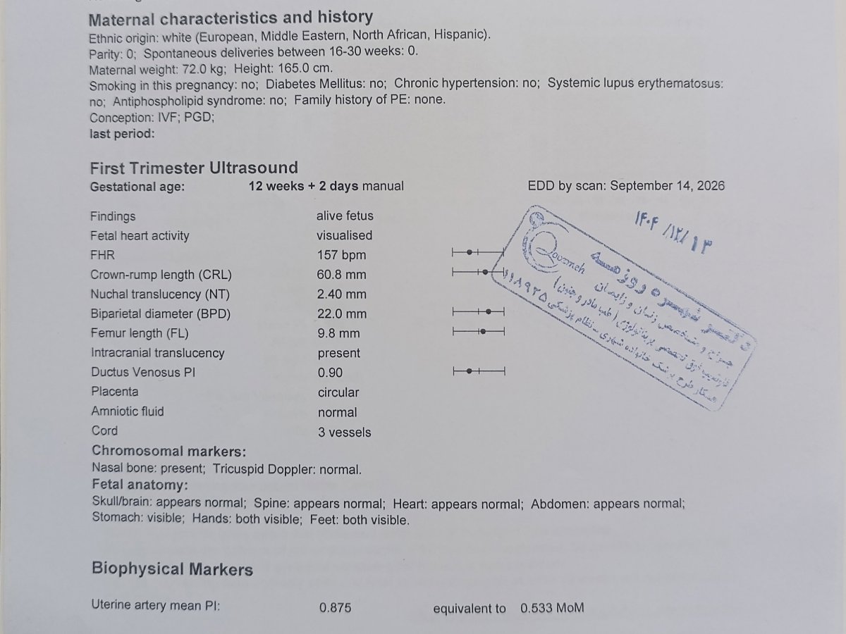 آمینوسنتز در جنین پی جی دی آمینوسنتز در جنین پی جی دی