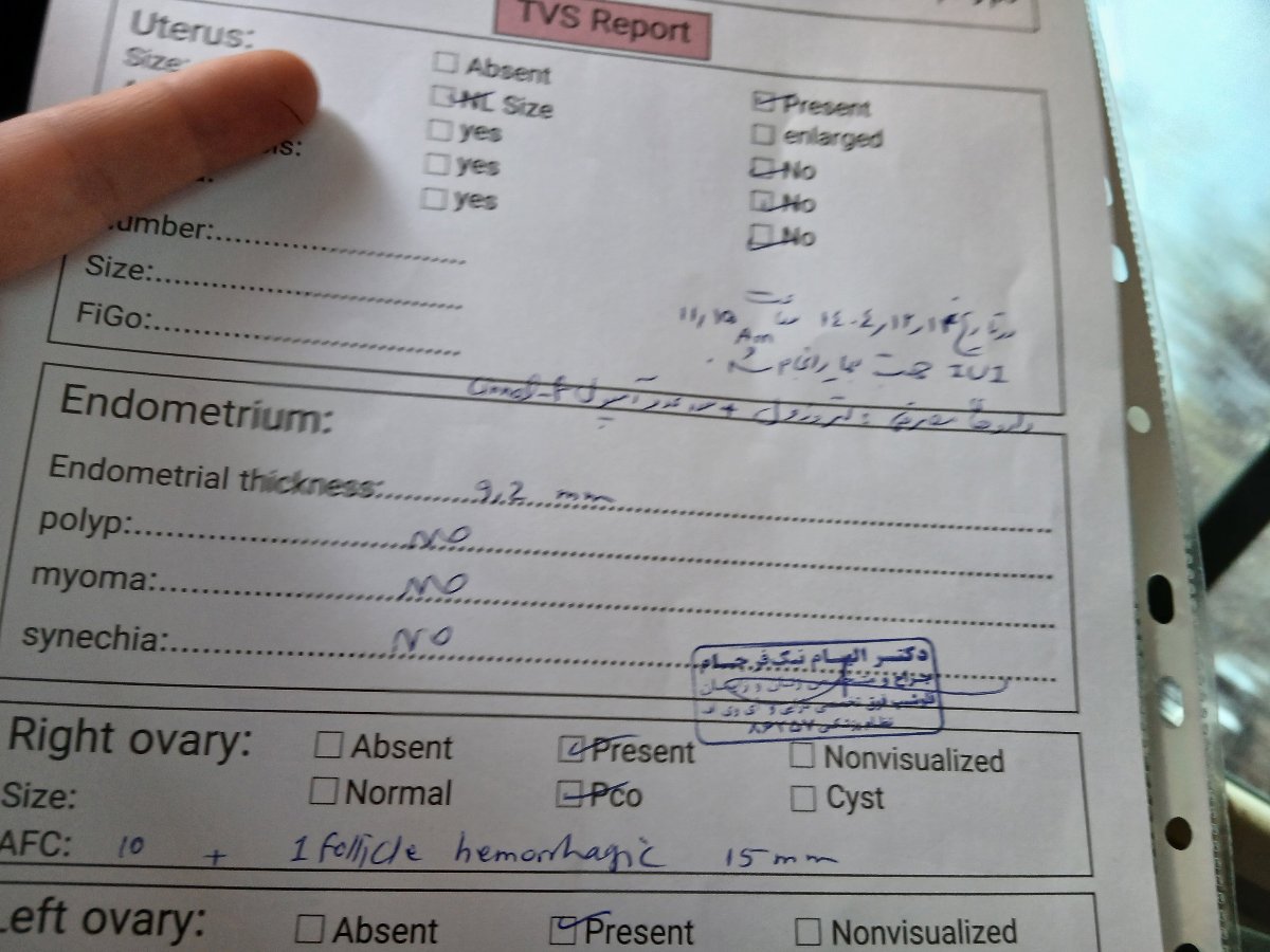 تفسیرسنوگرافی واژینال قبل آی یوآی