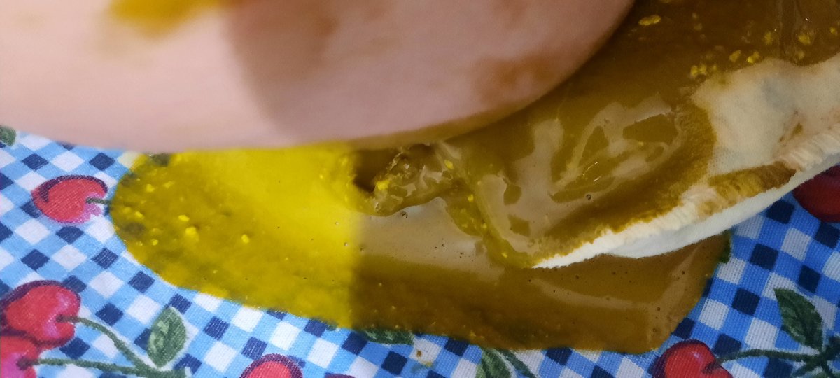 خوردن قارچ در شیردهی و حساسیت خوردن قارچ در شیردهی و حساسیت