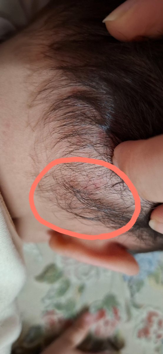 سلام خانم دکتر عزیز اگه تو عکس معلوم باشه براتون قرمزیم داره
البته شاید از خاروندنش باشه نمیدونم سلام خانم دکتر عزیز اگه تو عکس معلوم باشه براتون قرمزیم داره
البته شاید از خاروندنش باشه نمیدونم