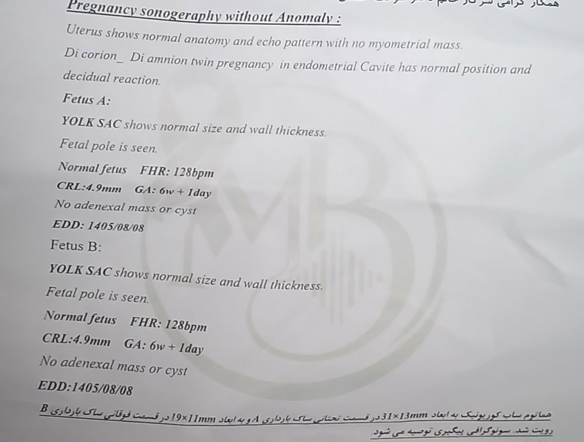 رویت هماتوم در سونو