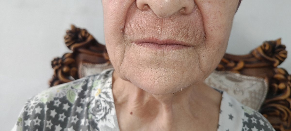 سلام خانم دکتر حساسیت پوستی