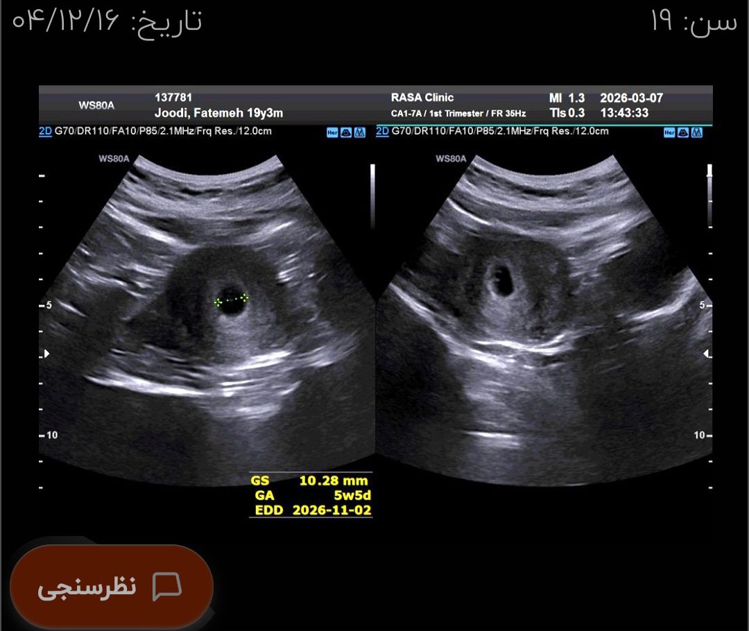 جوجه بنده که بخاطر قبلش نگرانم کرده