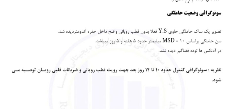اینو نوشتن عزیزم