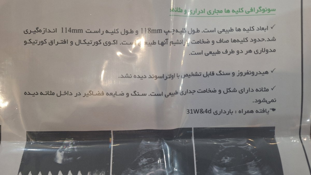 این سونو این سونو