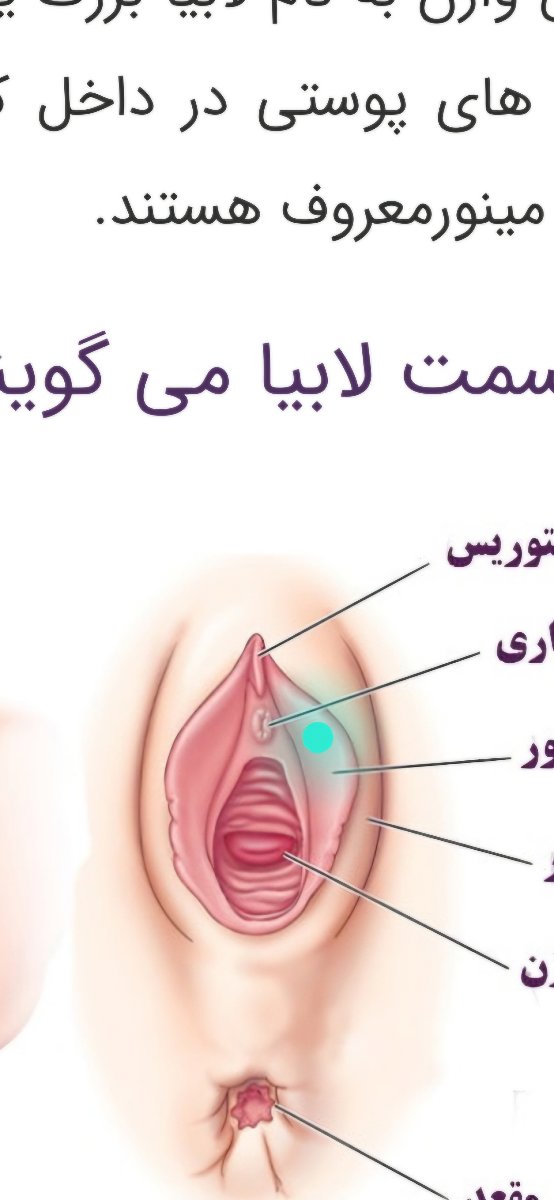 علت و درمان جوش واژن