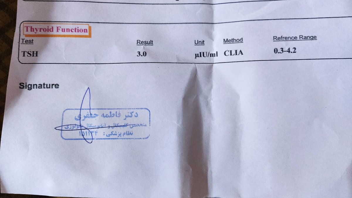 برند قرص تیروئید کم کار برند قرص تیروئید کم کار