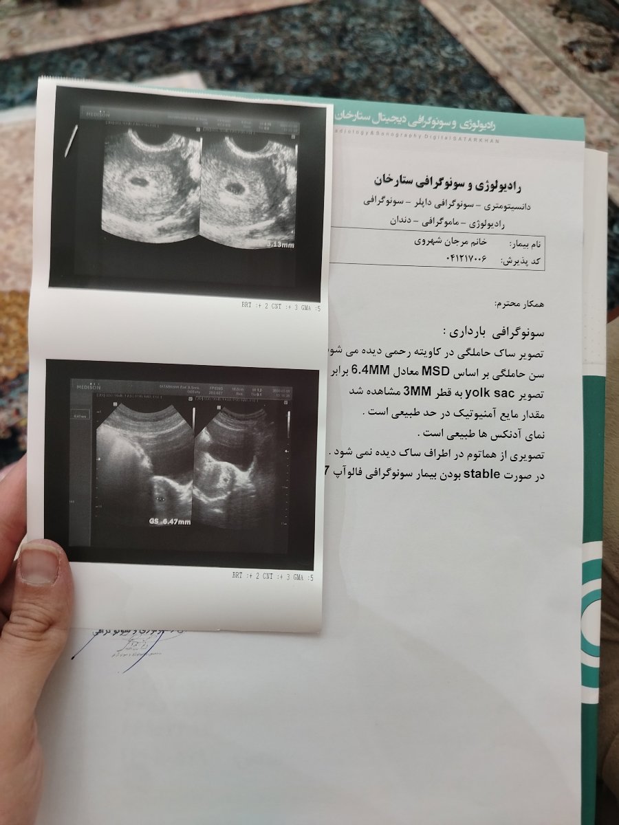 تحلیل سونوگرافی ساک بارداری