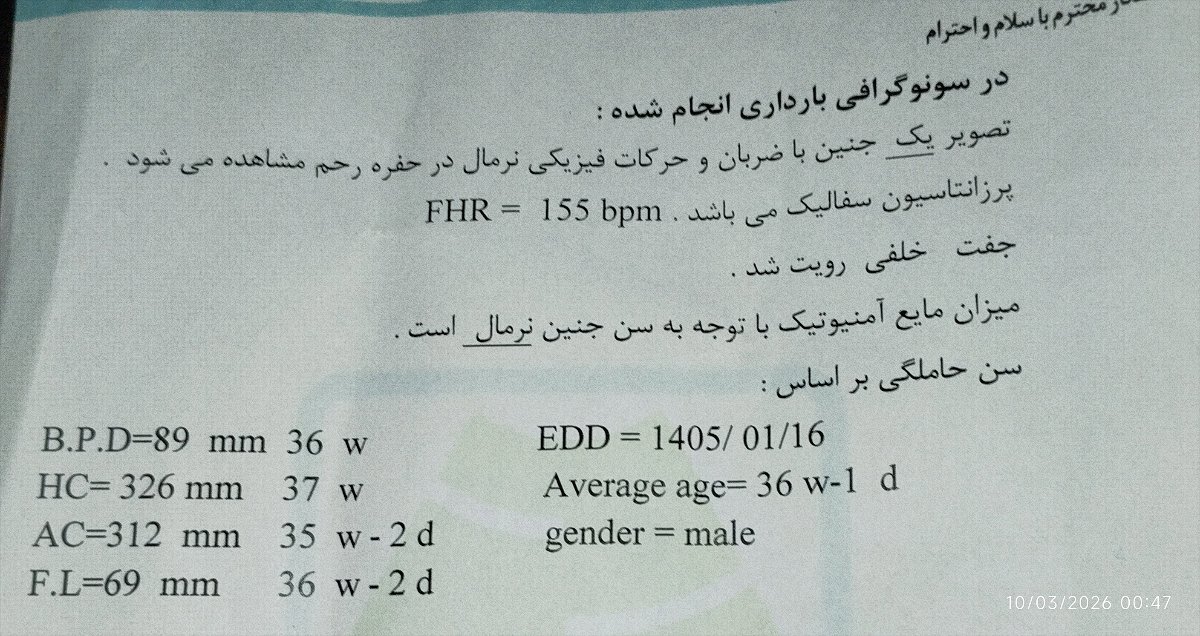 این سونو امشبم که به حساب خودم. ۳۴هفته و هفت روز میشم ولی سونو زده ۳۶هفته و یک روز این سونو امشبم که به حساب خودم. ۳۴هفته و هفت روز میشم ولی سونو زده ۳۶هفته و یک روز