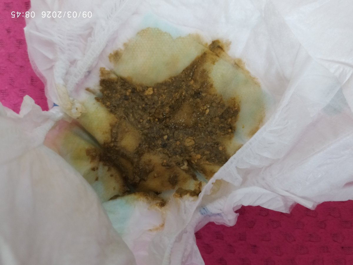اینم عکس ببخشید بازم 🙏🏿