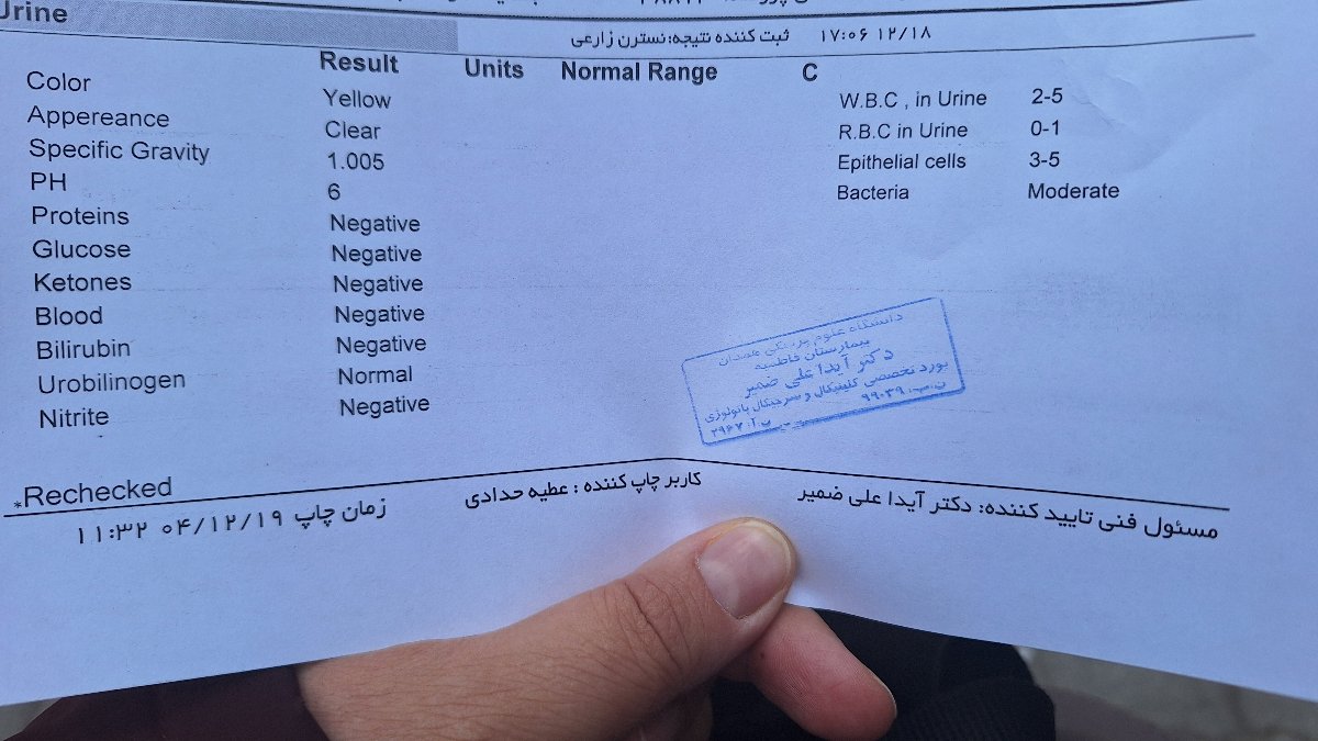 خانم دکتر دیروز رفتم برای انقباض بیمارستان
این ازمایش برای درد پهلو گرفتنچطوره خانم دکتر دیروز رفتم برای انقباض بیمارستان
این ازمایش برای درد پهلو گرفتنچطوره