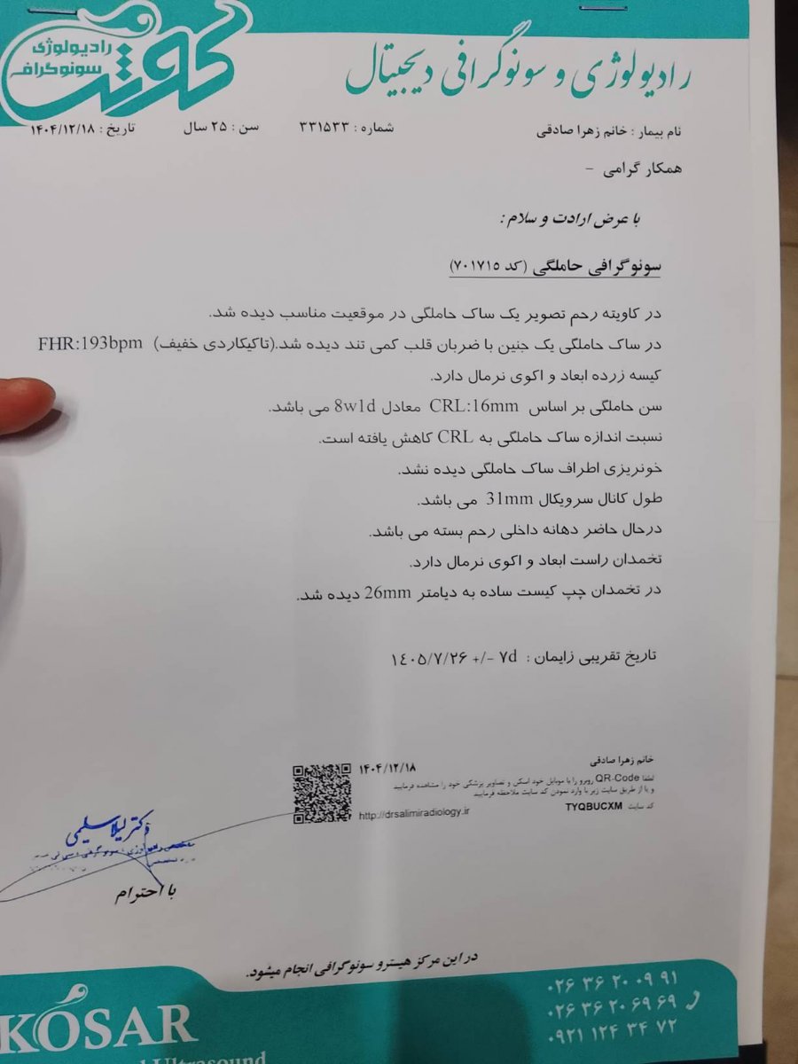 سایز ساک بارداری بارداری سایز ساک بارداری بارداری