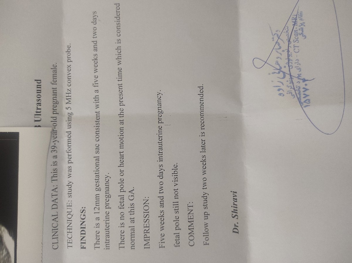 قلب جنین کی تشکیل میشه