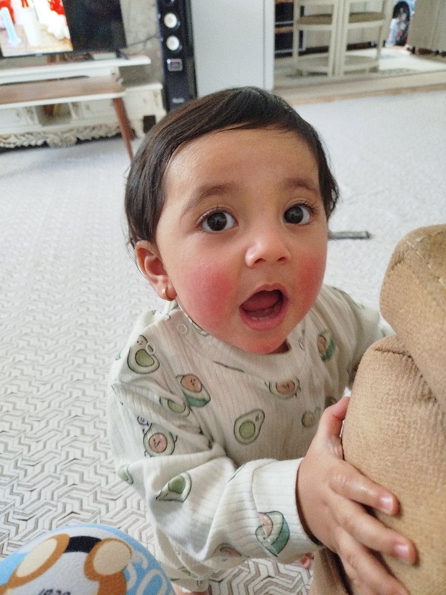 بیین صورتش دقیقا مثل صورت پسرته احتمال زیاد برای پسرت هم حساسیتع بیین صورتش دقیقا مثل صورت پسرته احتمال زیاد برای پسرت هم حساسیتع