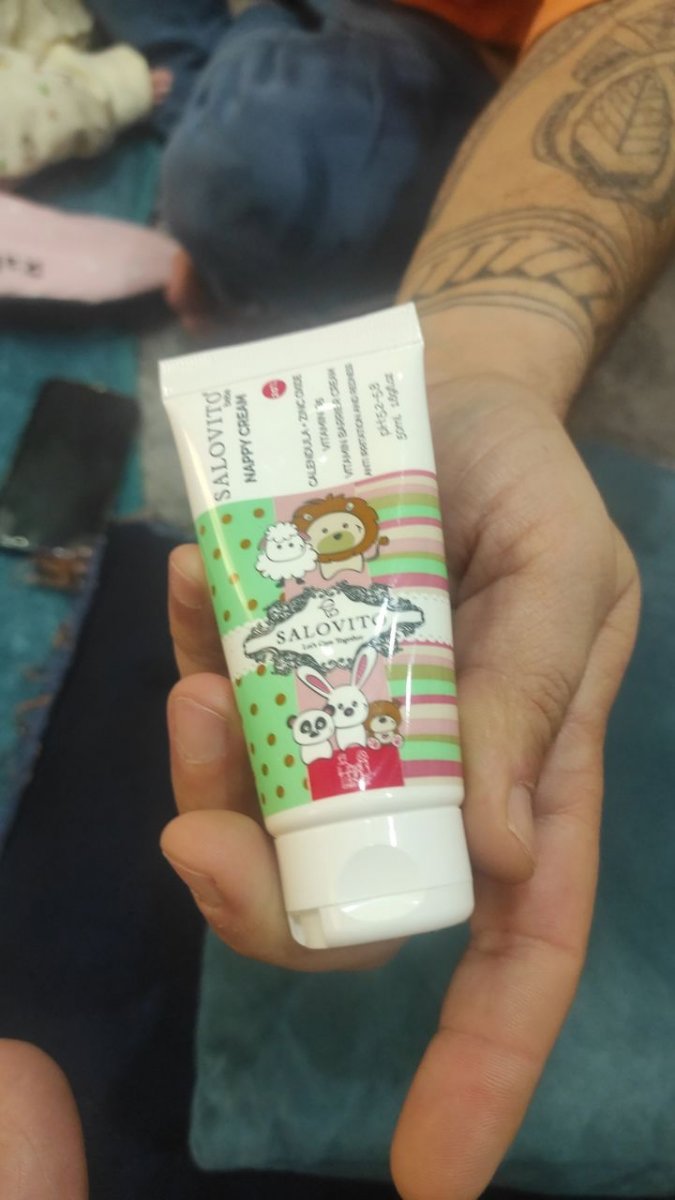 سوختگی محل دفع نوزاد سوختگی محل دفع نوزاد