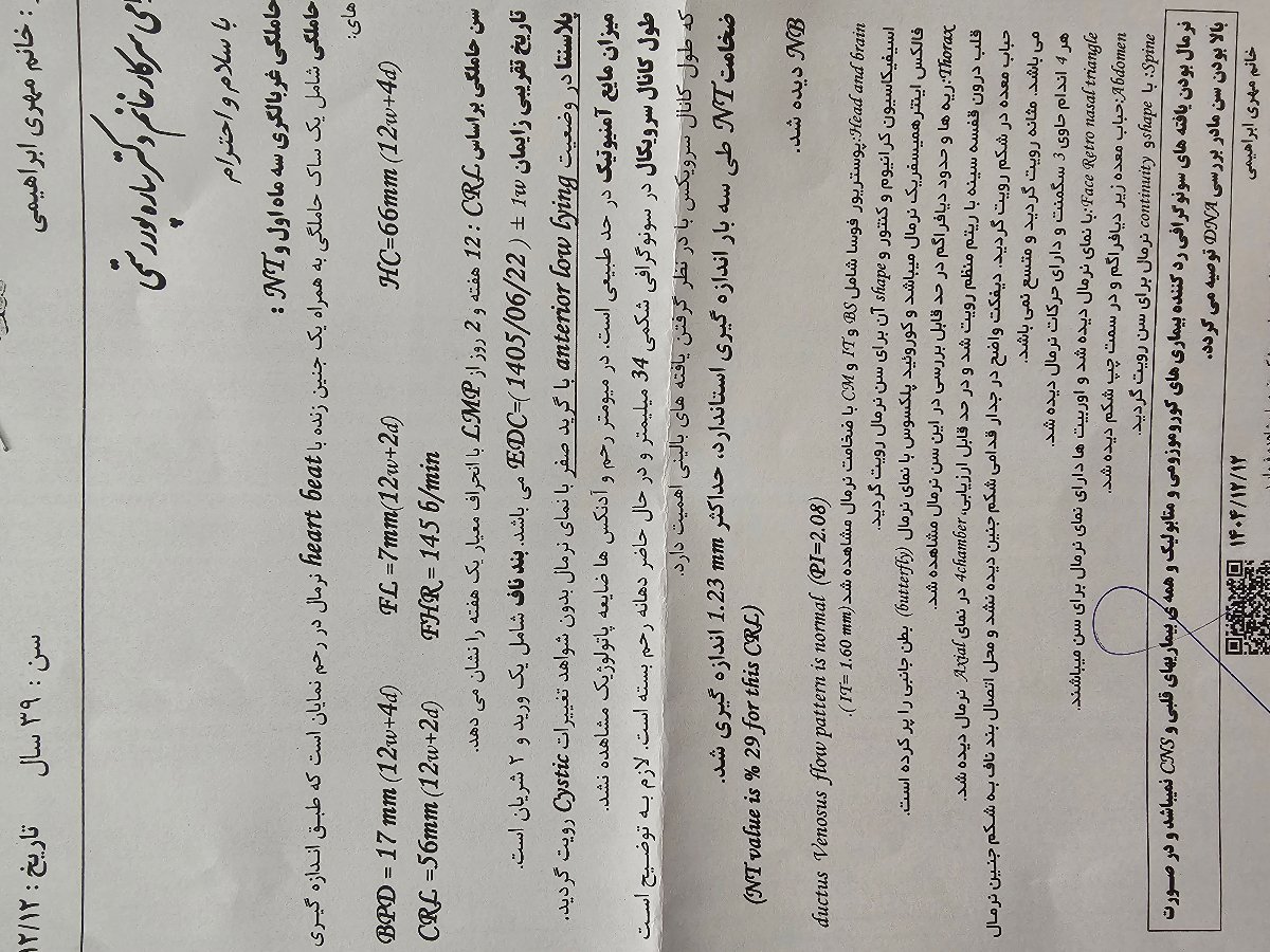 جنسیت نی نیم چیه تا وقت آنومالی