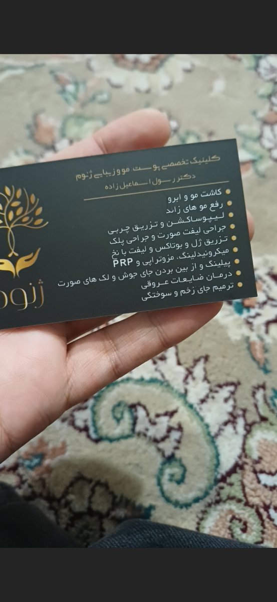 زگیل کنار ناخن انگشت دست