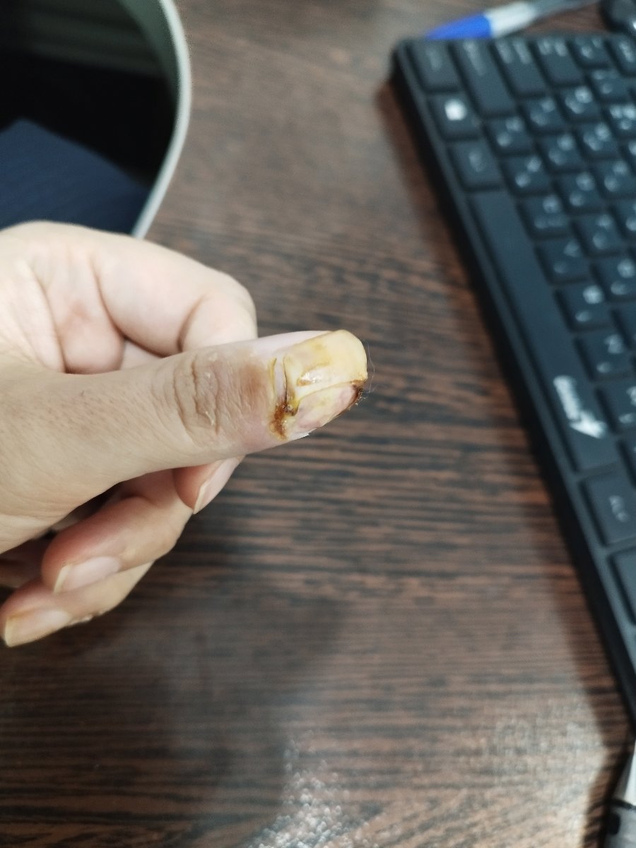 اینم دست چپه نصفش رفت 