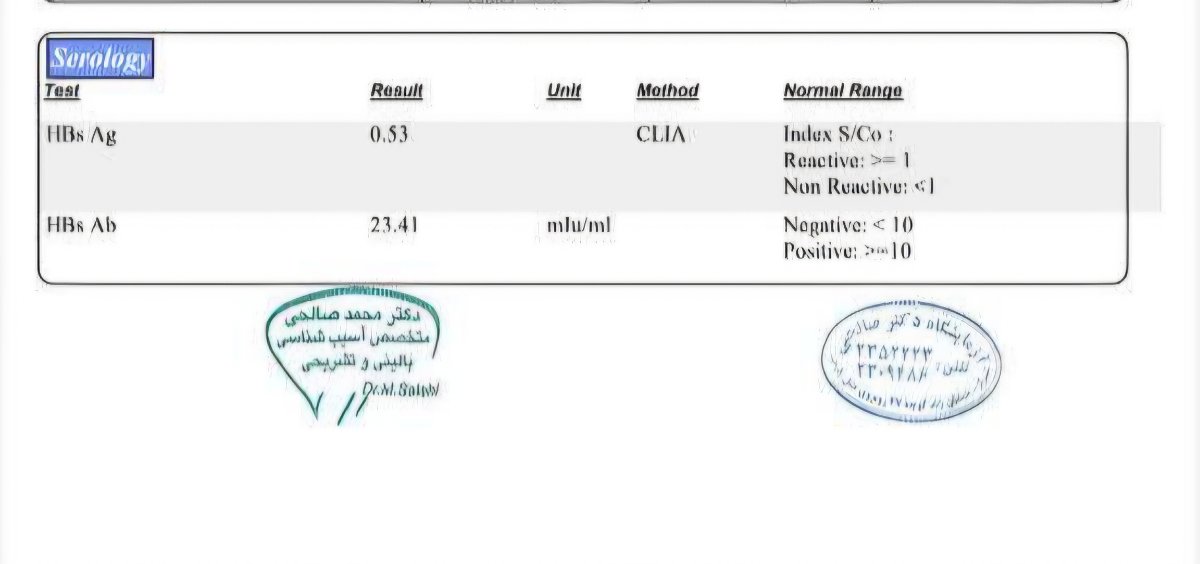 آزمایش کودک ۷ساله آزمایش کودک ۷ساله