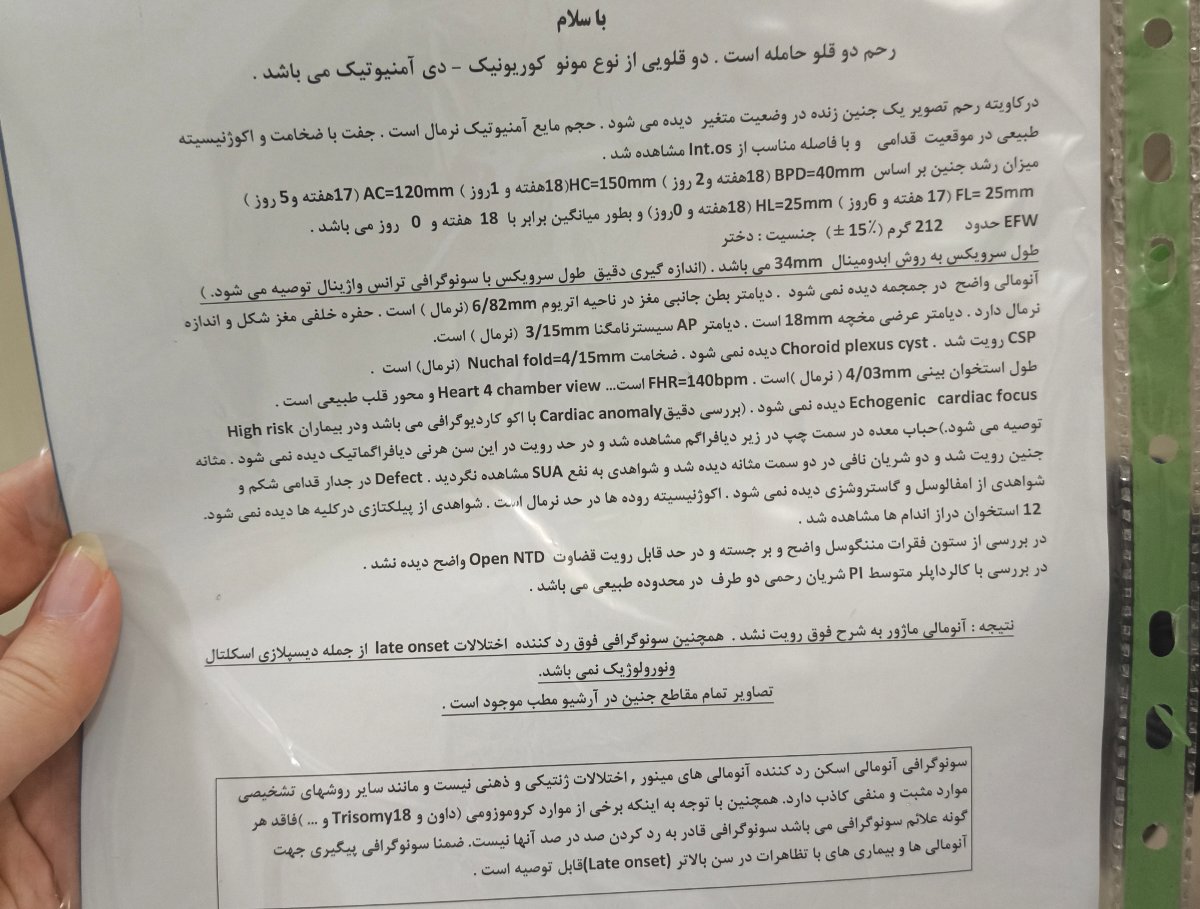تحلیل آنومالی دو قلو