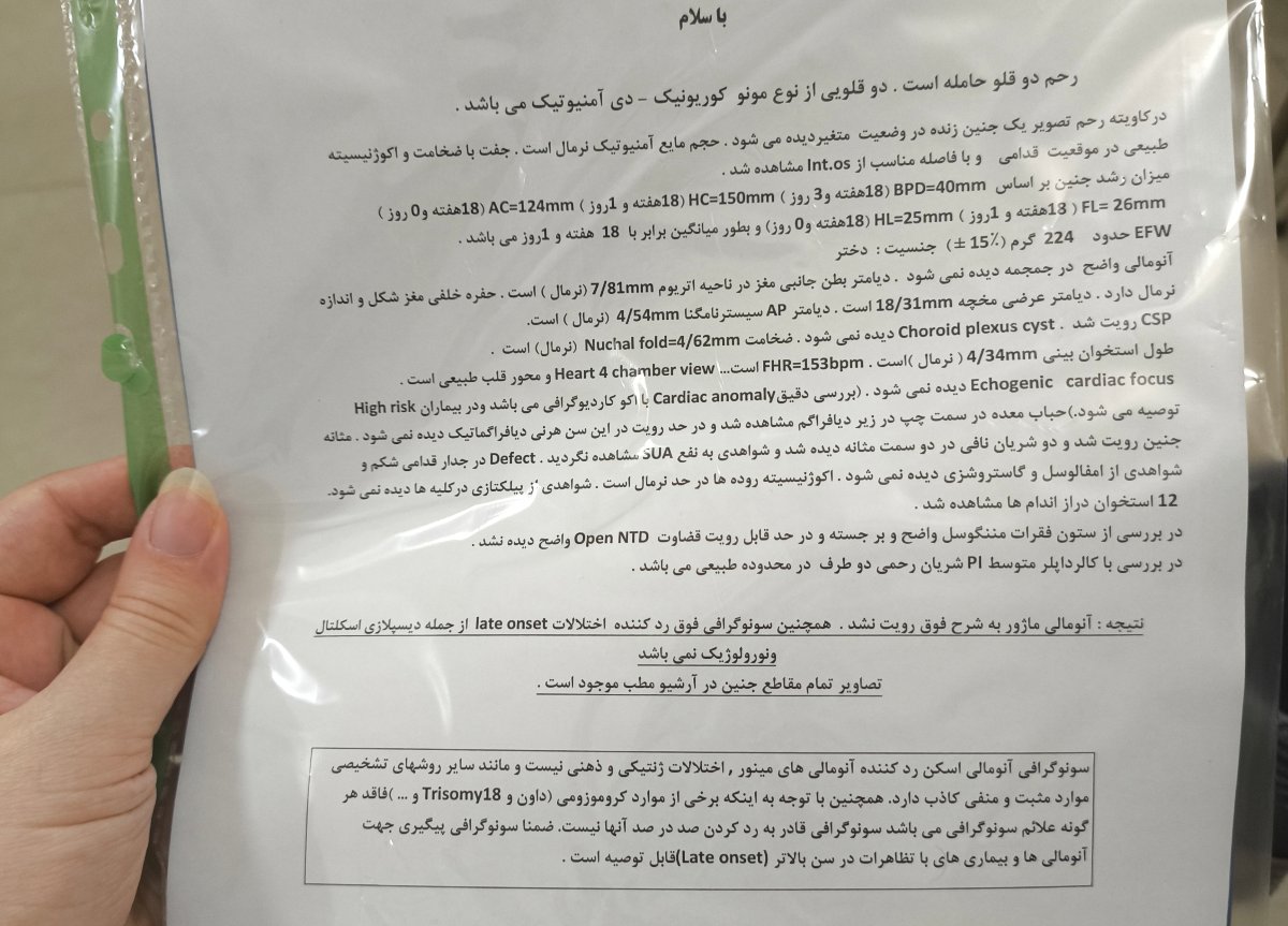 تحلیل آنومالی دو قلو