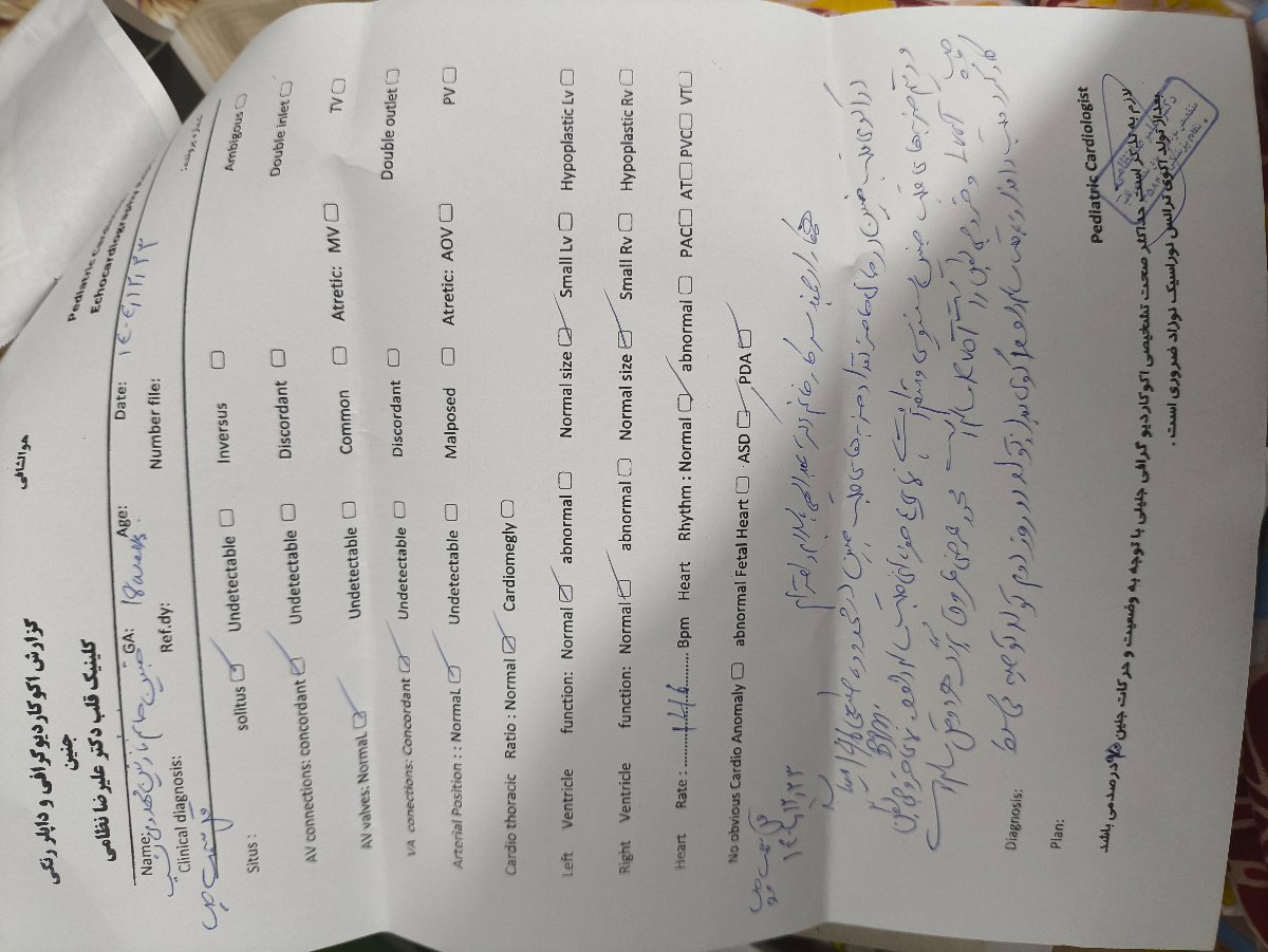تحلیل آنومالی دو قلو