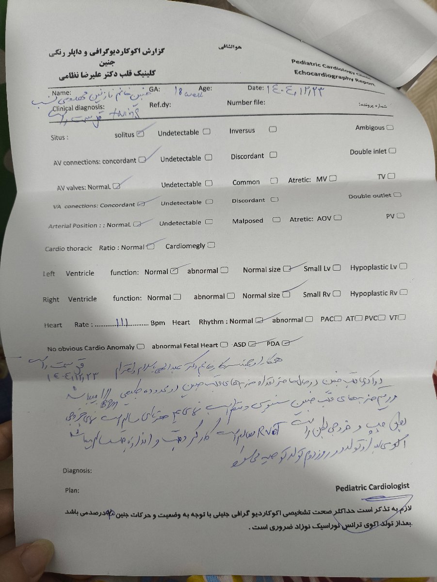 تحلیل آنومالی دو قلو