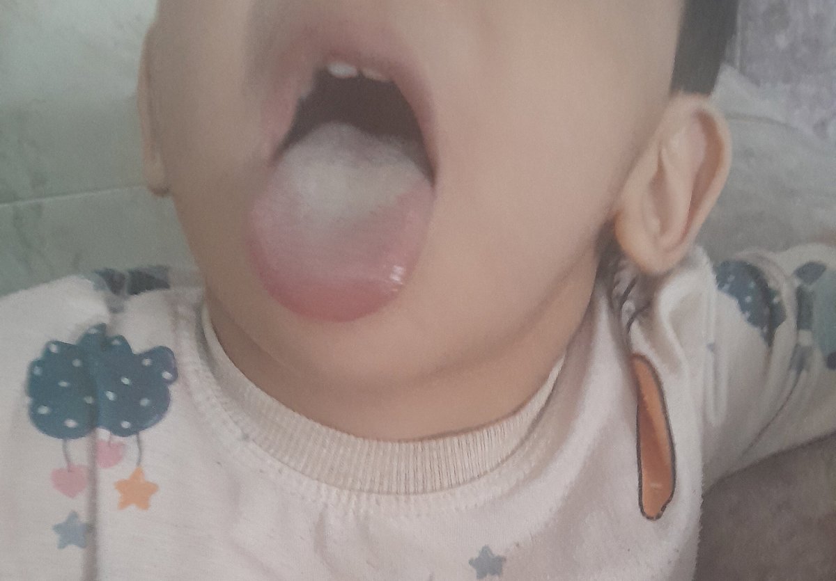 زبون پسر۲سالونیم ۲روزه سفیدشده