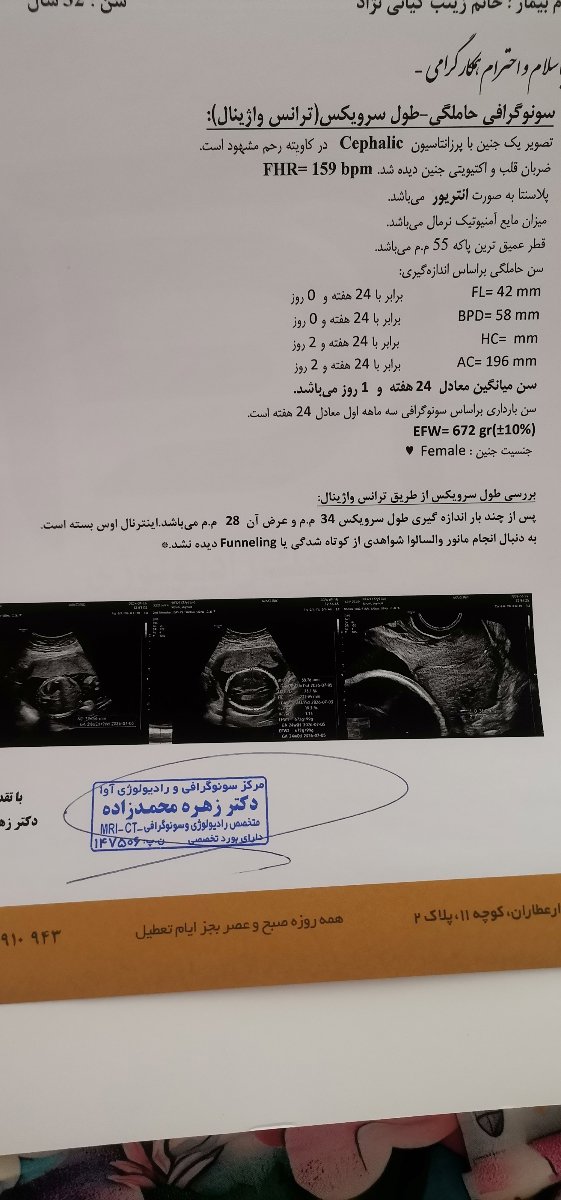 درد زیر شکم در هفته 24 درد زیر شکم در هفته 24