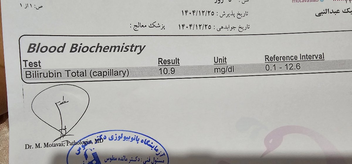 گریه مداوم نوزاد ۳ روزه