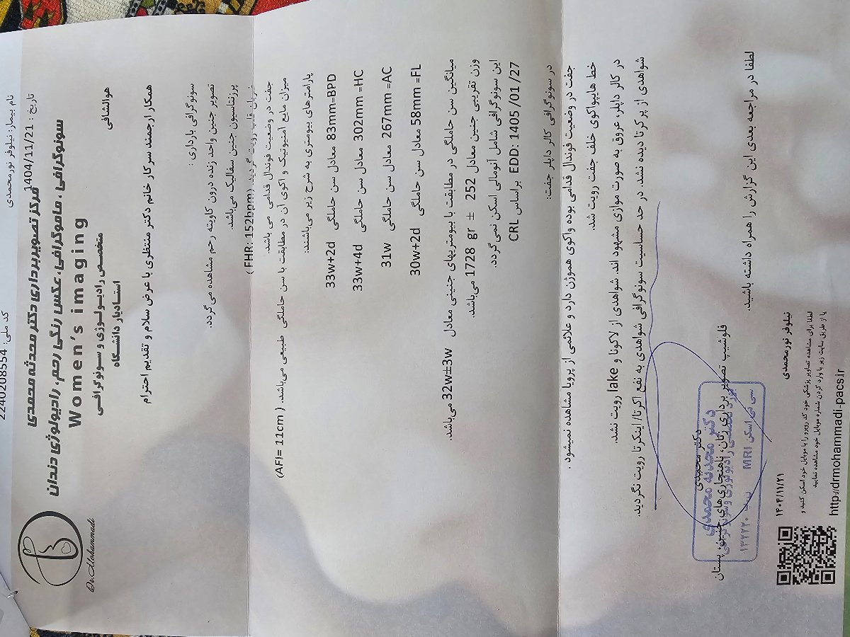 سونوی ماه قبل سونوی ماه قبل