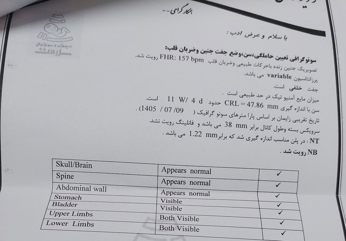 تفسیر سونو nt رو لطف میکنید؟