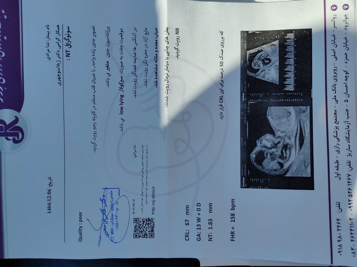 سلام خانم دکتر میشه لطف کنید سونو ان تی و ازمایش غربالگری رو برام تفسیر کنید ؟ سلام خانم دکتر میشه لطف کنید سونو ان تی و ازمایش غربالگری رو برام تفسیر کنید ؟