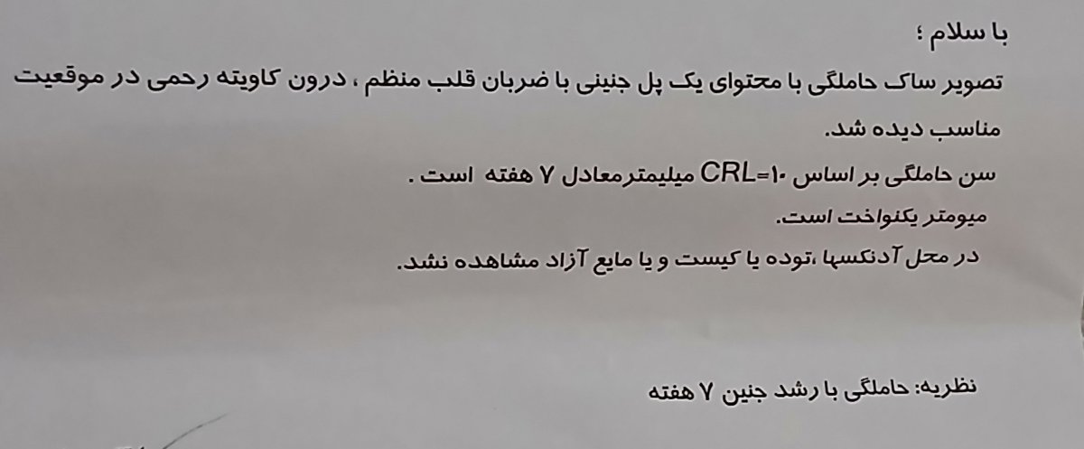 این متنه این متنه